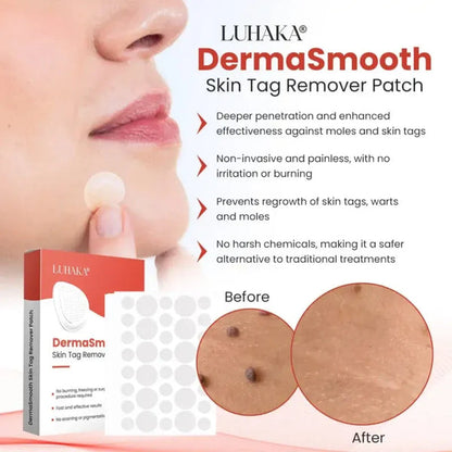 Derma Smooth Skin Tag Removal Patch | 72 Patches |
